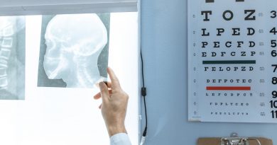 a doctor holding x ray of a person s head